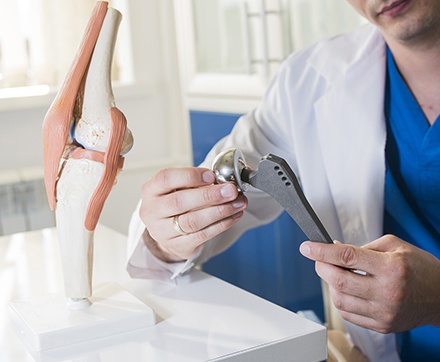 Implantes de Trauma